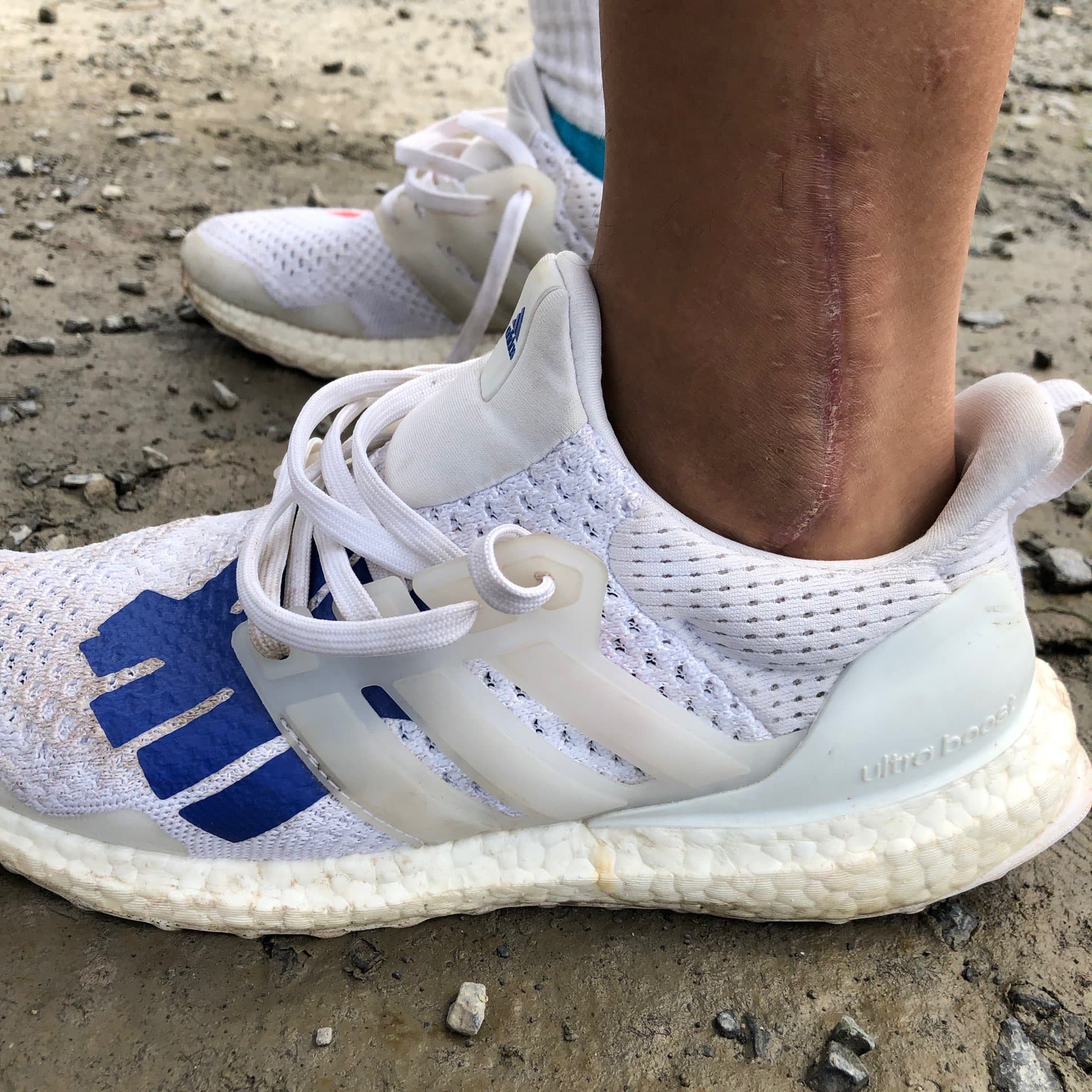 UNDEFEATED x adidas ULT Boost - фото покупателя Дима
